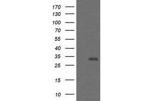 Image no. 1 for anti-Proteasome (Prosome, Macropain) Inhibitor Subunit 1 (PI31) (PSMF1) antibody (ABIN1500490) (PSMF1 抗体)