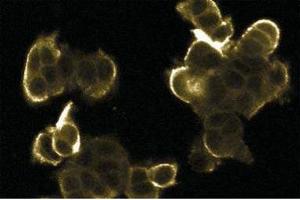 Immunofluorescence staining of MCF7 cells. (ERK2 抗体  (AA 219-358))