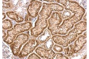 IHC-P Image VHL antibody detects VHL protein at cytosol on mouse kidney by immunohistochemical analysis. (VHL 抗体)