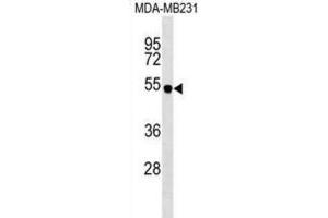 Western Blotting (WB) image for anti-Spinster Homolog 2 (SPNS2) antibody (ABIN2999753) (SPNS2 抗体)