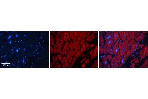 Rabbit Anti-FUBP1 Antibody   Formalin Fixed Paraffin Embedded Tissue: Human heart Tissue Observed Staining: Cytoplasmic, nucleus Primary Antibody Concentration: 1:100 Other Working Concentrations: N/A Secondary Antibody: Donkey anti-Rabbit-Cy3 Secondary Antibody Concentration: 1:200 Magnification: 20X Exposure Time: 0. (FUBP1 抗体  (N-Term))