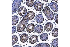 IHC analysis of SAE1 using anti-SAE1 antibody (ABIN7601346).