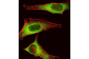 Fluorescent image of Hela cell stained with TEC Antibody . (NR4A3 抗体  (AA 175-205))