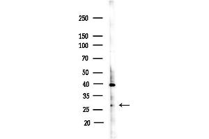 Western blot analysis of lysates from COLO205 cells(heat-shock,45 min treatment), using ARHGDIB Antibody at 1/1000 dilution.