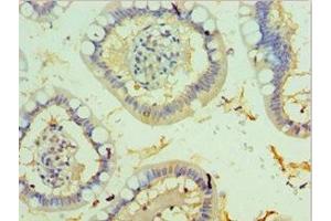 Immunohistochemistry of paraffin-embedded human small intestine tissue using ABIN7173327 at dilution of 1:100 (Trefoil Factor 2 抗体  (AA 24-129))