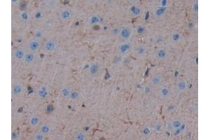 Detection of ErbB3 in Mouse Cerebrum Tissue using Polyclonal Antibody to V-Erb B2 Erythroblastic Leukemia Viral Oncogene Homolog 3 (ErbB3) (ERBB3 抗体  (AA 707-964))