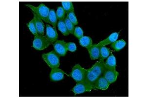 IF analysis of RAB11B using anti-RAB11B antibody (ABIN7602766).