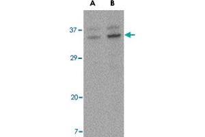 Western blot analysis of ORAI3 in A-20 cell lysate with ORAI3 polyclonal antibody  at (A) 2 and (B) 4 ug/mL . (ORAI3 抗体  (C-Term))