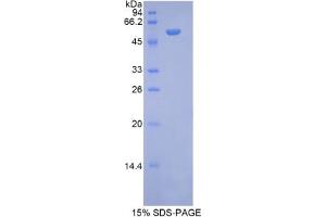 SDS-PAGE analysis of Rat NAGLU Protein. (N-Acetyl alpha-D-Glucosaminidase 蛋白)