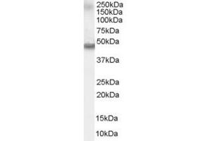 ABIN185366 staining (0. (Retinoic Acid Receptor alpha 抗体  (C-Term))