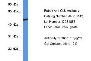 Western Blotting (WB) image for anti-Clusterin (CLU) (C-Term) antibody (ABIN2788692) (Clusterin 抗体  (C-Term))