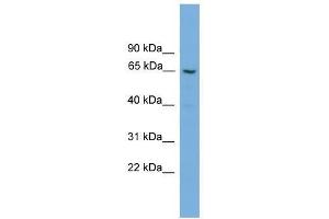 GGT2 antibody used at 0. (gGT2 抗体  (N-Term))