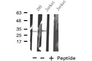 Western blot analysis of extracts from Jurkat/293 cells, using KCNK7 antibody. (KCNK7 抗体)