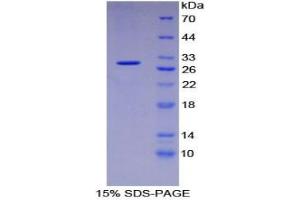 SDS-PAGE analysis of Human Intercellular Adhesion Molecule 3 Protein. (ICAM-3/CD50 蛋白)