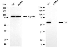 Western blotting analysis using GDI1 antibody (ABIN7798700).