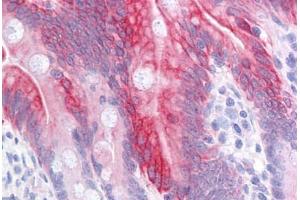 Human Small Intestine: Formalin-Fixed, Paraffin-Embedded (FFPE) (KRT20 抗体  (AA 1-425))