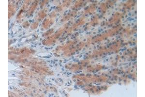 Immunohistochemistry (IHC) image for anti-Involucrin (IVL) (AA 461-551) antibody (ABIN7437494)