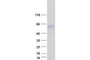 Western Blotting (WB) image for Activin Receptor Type I (ACRV1) (Transcript Variant 2) protein (Myc-DYKDDDDK Tag) (ABIN2714364)