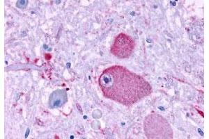 Immunohistochemistry (Formalin/PFA-fixed paraffin-embedded sections) of human brain, neurons and glia with GPR37 polyclonal antibody . (GPR37 抗体  (Extracellular Domain))