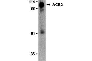 Western Blotting (WB) image for anti-Angiotensin I Converting Enzyme 2 (ACE2) (Middle Region 2) antibody (ABIN1031195)