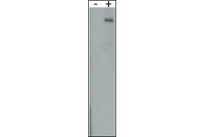 RK8 (LRRK2)Antibody  g detect over-expressed human LRRK2 protein. (LRRK2 抗体  (AA 931-962))
