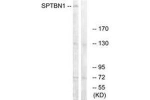 Western blot analysis of extracts from COLO cells, using SPTBN1 Antibody. (SPTBN1 抗体  (AA 651-700))