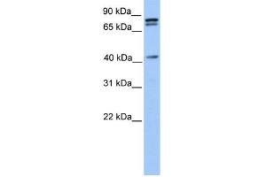 WB Suggested Anti-SUZ12 Antibody Titration:  0. (SUZ12 抗体  (C-Term))