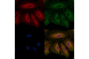 ABIN6257585 and ABIN6274582 staining  cells by IF/ICC.