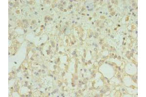 Immunohistochemistry of paraffin-embedded human adrenal gland tissue using ABIN7173203 at dilution of 1:100 (TMEM33 抗体  (AA 177-247))