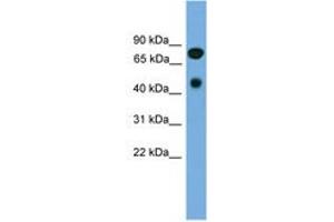 Image no. 1 for anti-Receptor-Interacting Serine-threonine Kinase 4 (RIPK4) (AA 179-228) antibody (ABIN6744810)