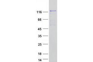 Validation with Western Blot (ABL2 Protein (ABL2) (Transcript Variant A) (Myc-DYKDDDDK Tag))