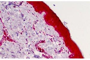 Human Skin: Formalin-Fixed, Paraffin-Embedded (FFPE) (Caspase 4 抗体)