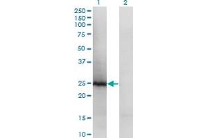 Western Blot analysis of TSN expression in transfected 293T cell line by TSN polyclonal antibody (A01). (Translin 抗体  (AA 115-197))