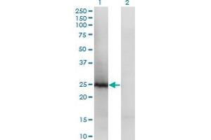 Western Blot analysis of TSN expression in transfected 293T cell line by TSN polyclonal antibody (A01).