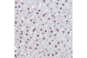 Immunohistochemistry of paraffin-embedded rat liver using PPARD Rabbit pAb (ABIN6132423, ABIN6146002, ABIN6146003 and ABIN6221300) at dilution of 1:100 (40x lens). (PPARD 抗体  (AA 102-361))