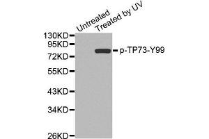 Western blot analysis of extracts from 293 cells, using Phospho-TP73-Y99 antibody. (Tumor Protein p73 抗体  (pTyr99))