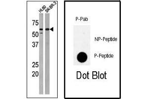 Image no. 1 for anti-Protein Kinase, Membrane Associated tyrosine/threonine 1 (PKMYT1) (pThr495) antibody (ABIN358168) (PKMYT1 抗体  (pThr495))
