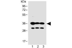 Western blot testing of human 1) SH-SY5Y, 2) PANC-1 and 3) MCF-7 cell lysate with OR5V1 antibody at 1:1000. (OR5V1 抗体  (AA 241-274))