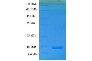SDS-PAGE (SDS) image for Potassium Voltage-Gated Channel, Isk-Related Family, Member 2 (KCNE2) (AA 70-123) protein (His tag) (ABIN1476167)