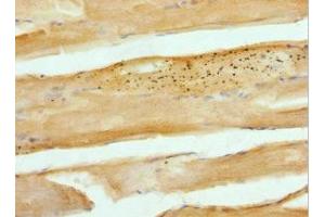 Immunohistochemistry of paraffin-embedded human skeletal muscle tissue using ABIN7146447 at dilution of 1:100 (CAMK2B 抗体  (AA 1-300))