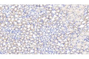 Detection of IL1RA in Mouse Kidney Tissue using Polyclonal Antibody to Interleukin 1 Receptor Antagonist (IL1RA)