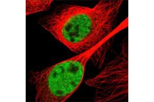 Immunofluorescent staining of human cell line U-2 OS shows positivity in nucleus but not nucleoli. (SMEK2 抗体)