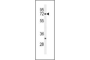 Western blot analysis of HRD1 Antibody (N-term) (ABIN650702 and ABIN2839220) in SK-BR-3 cell line lysates (35 μg/lane). (SYVN1 抗体  (N-Term))