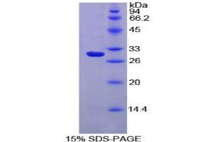 SDS-PAGE analysis of Rat MPG1 Protein. (MPEG1 蛋白)