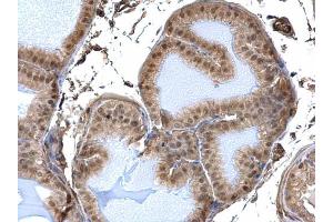 IHC-P Image DDB1 antibody detects DDB1 protein at nucleus and cytosol on mouse prostate by immunohistochemical analysis. (DDB1 抗体  (C-Term))