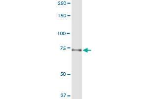 Immunoprecipitation of TUBGCP4 transfected lysate using anti-TUBGCP4 MaxPab rabbit polyclonal antibody and Protein A Magnetic Bead , and immunoblotted with TUBGCP4 purified MaxPab mouse polyclonal antibody (B01P) . (TUBGCP4 抗体  (AA 1-666))
