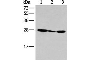 Western blot analysis of 293T cell lysate using HLA-DOB Polyclonal Antibody at dilution of 1:400 (HLA-DOB 抗体)