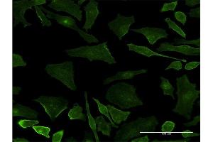 Immunofluorescence of monoclonal antibody to UBXN11 on HeLa cell. (UBXN11 抗体  (AA 311-409))