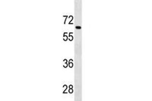 Tgfbr2 antibody western blot analysis in 293 lysate. (TGFBR2 抗体  (AA 548-575))