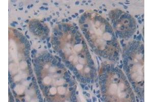 Detection of GAL2 in Rat Small intestine Tissue using Polyclonal Antibody to Galectin 2 (GAL2) (Gallinacin-2 (GAL2) (AA 1-130) 抗体)